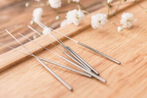 needles on a table at a Tampa fl acupuncture treatment